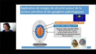 Webinaire Radiothrapie