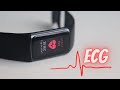 Fitbit charge 5 with ecg and nfc pay  worth it