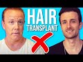 10 Reasons - Do Not Get A Hair Transplant
