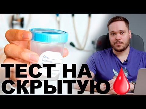 АНАЛИЗ КАЛА НА СКРЫТУЮ КРОВЬ. УДАСТСЯ ЛИ ИЗБЕЖАТЬ КОЛОНОСКОПИИ?