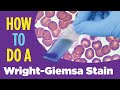 How to do a hematology stain wrightgiemsa stain laboratory tutorial procedure