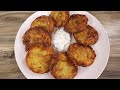 How to Make Hash Browns - Diner Style Restaurant Hashbrown Recipe