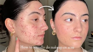 How to Make Makeup Look Smooth & Natural on Acne and Textured Skin screenshot 5