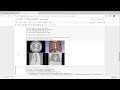 Medical image processing in your web browser using Jupyter notebooks and 3D Slicer