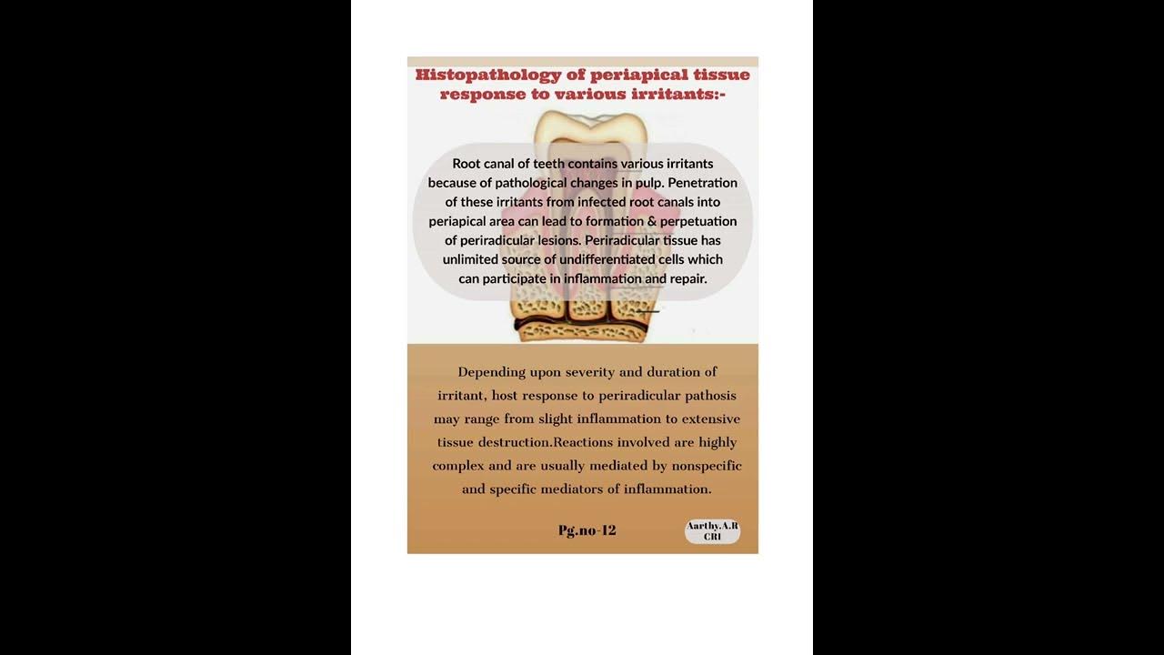 RATIONALE OF ENDODONTICS YouTube