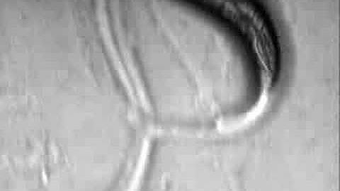 Phototaxis in head of the nematode C. elegans