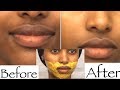 7 DAY TURMERIC AND POTATO FACE MASK TO TREAT DISCOLOURATION AND THIS HAPPENED