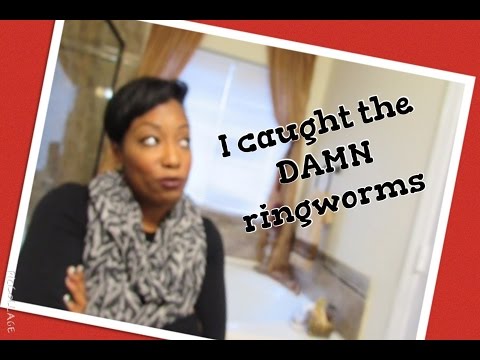 i-caught-the--ringworm-at-the-gym-+-how-i-got-rid-of-them-in-2-days