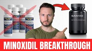 Download Lagu Minoxidil Won't Be Used The Same Way Again! (SAM-002) MP3