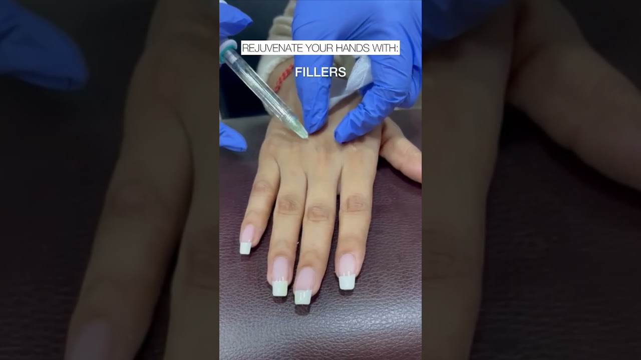 Treatment for Hand Rejuvenation