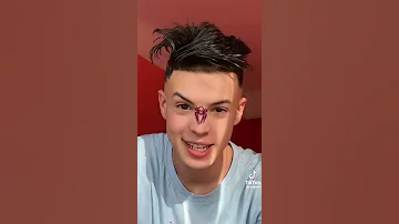 لوكان يبقا فيا عرق يضرب منوليلكش يالعقرب 
