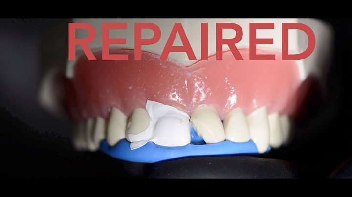 How the dentist repairs a chipped tooth