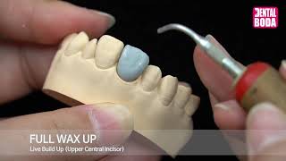 Full wax up (Upper Central Incisor)