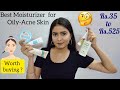 Best Moisturizers for Oily-Acne Prone Skin | Kashika Chauhan