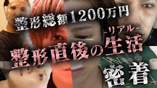 【整形直後１ヶ月間の記録】ホストの整形を全公開｜歌舞伎町で「顔面国宝」と呼ばれた男の生活に密着【ACQUA】