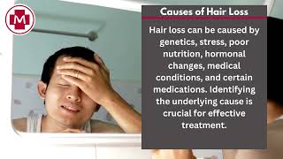 MEDISELLER - TREATMENT FOR HAIR-LOSS