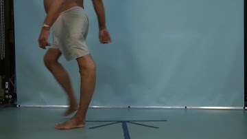 The UTX in action: severe hyperextension