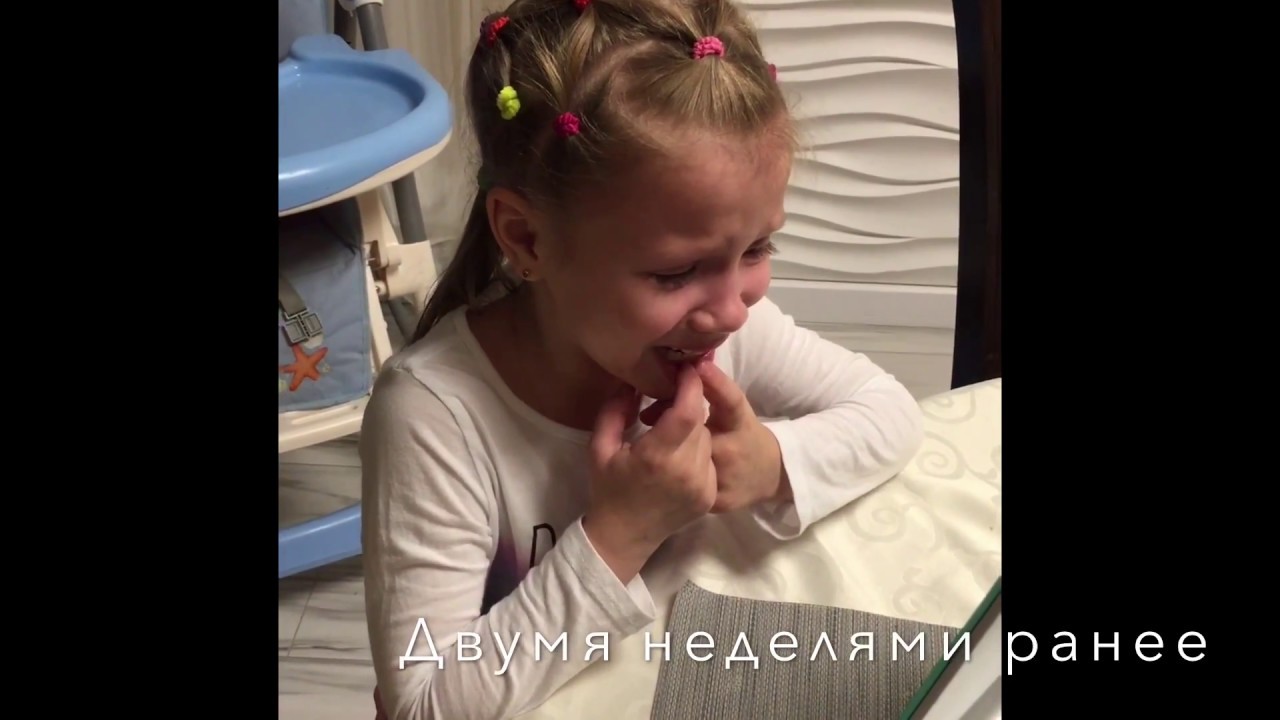 КАК ВЫРВАТЬ ПЕРВЫЙ МОЛОЧНЫЙ ЗУБ - YouTube