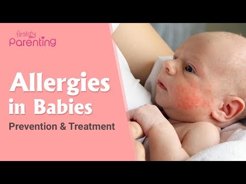 Video: How To Treat Newborn Allergies