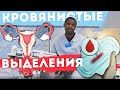 Кровянистые выделения. Причины, лечение.