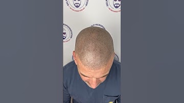 SMP Transformation | REGAIN YOUR CONFIDENCE WITH SMP!