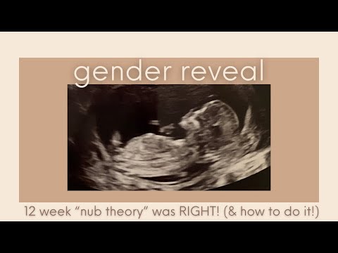 Vidéo: Nub Theory: Est-ce Que «Angle Of The Dangle» Prédit Le Sexe De Bébé?