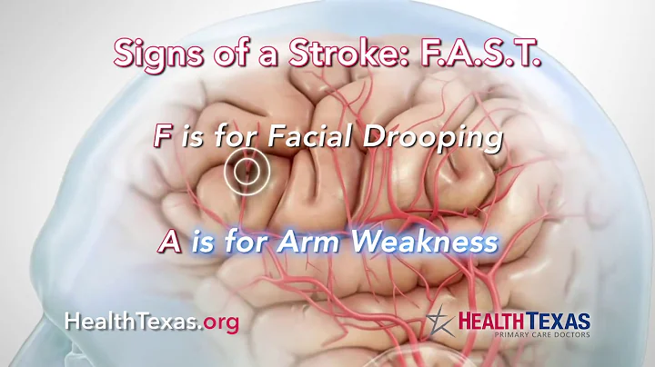 Stroke - Keeping Texans Healthy - HealthTexas Medical Group