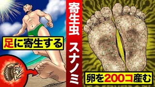 【両足切断】足を食い荒らす寄生虫…スナノミ。人間の体内に卵200個を産む。