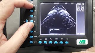 Ultrassom MS Multiscan: parte 5.1 (ABC ajuste - Nome) - MS Schippers Brasil