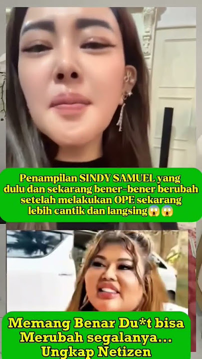 Transformasi Wajah Shindy Samuel Setelah Oplas, Gak Nyangka😱😱 #shindysamuel