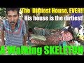 You Won't Believe How Dirty His House Is! The Filipino Skeleton Man of the Philippines