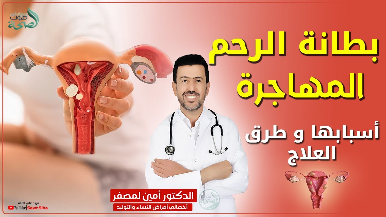 شنو هي بطانة الرحم المهاجرة ؟ اسبابها وطرق العلاج مع الدكتور أمين لمصفر أخصائي أمراض النساء والتوليد