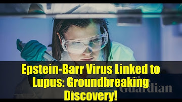Epstein-Barr Virus Linked to Lupus: Groundbreaking Discovery!