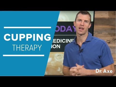 Cupping Therapy: Alternative Medicine for Pain, Immunity & Digestion