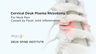 Causes of Cervical Facet Inflammation & Injury - (3D Animation) by Deuk Spine Institute 216 views 1 month ago 25 seconds