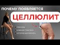 Почему появляется ЦЕЛЛЮЛИТ? (причины, влияние генетики, история)