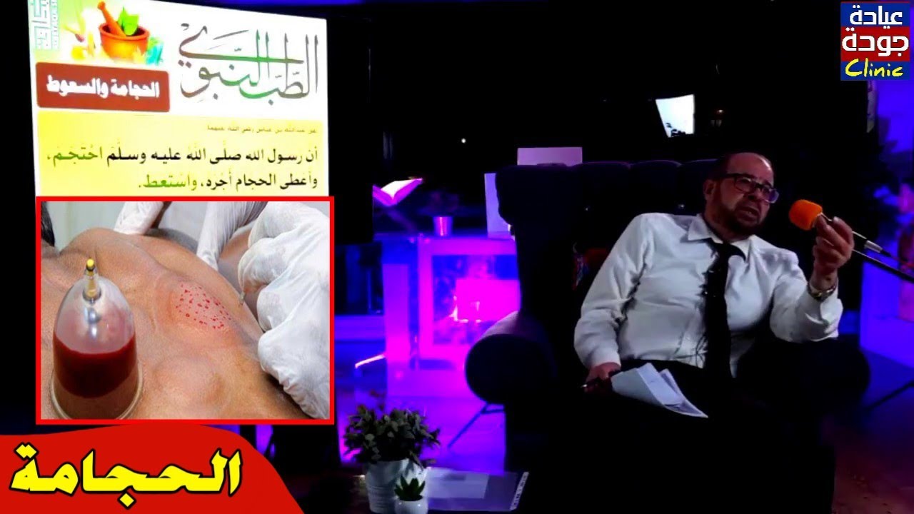 الحجامة لا ينفع فيها التشريط خالص   ولكن الوخز فقط | دكتور جودة محمد عواد