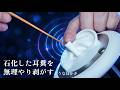 ASMR Deep Ear Cleaning on a Stone-Like Ear (No Talking)