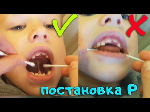 ПОСТАНОВКА ЗВУКА Р