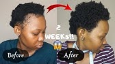 How to Regrow your Edges, Bald Spots, and Thinning Hair! - YouTube