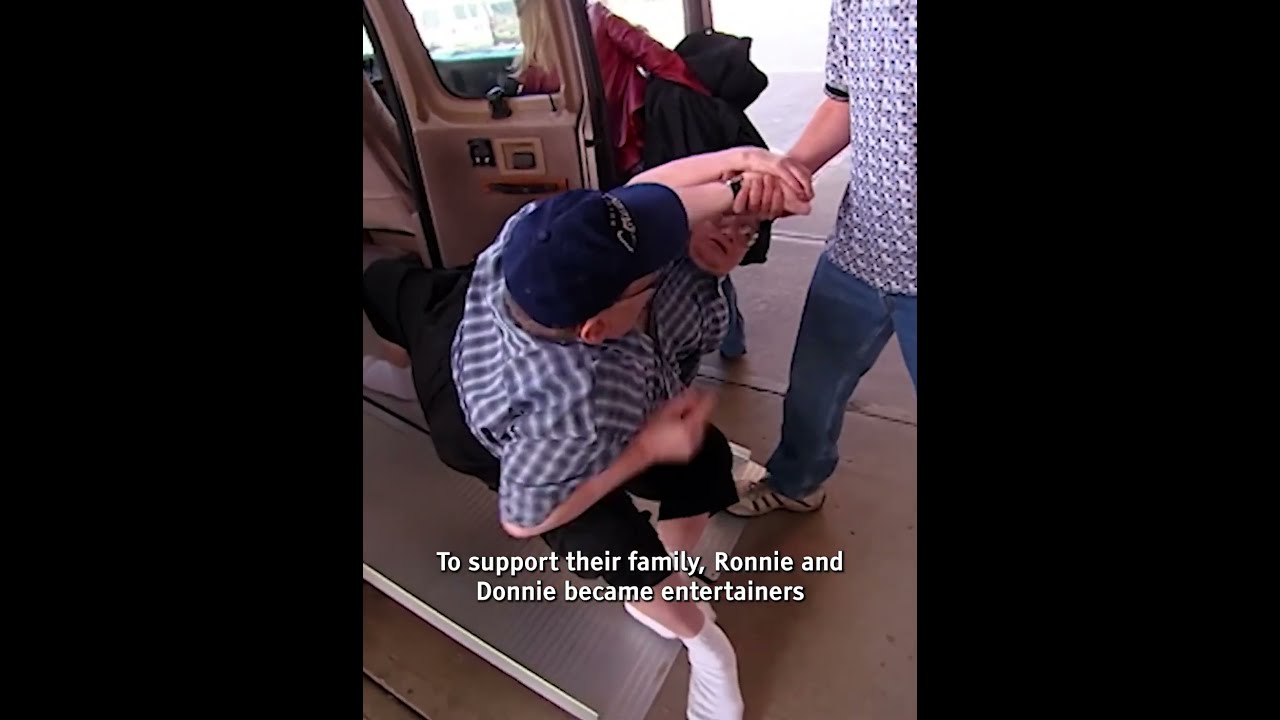 World S Longest Living Conjoined Twins Pass Away RonnieAndDonnie RecordBreakers TwinsBond