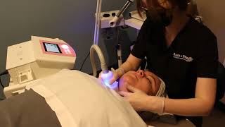 Cryoskin Facial