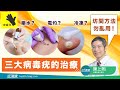 皮膚百科 三大病毒疣的治療 皮膚百科 三大病毒疣的治療
