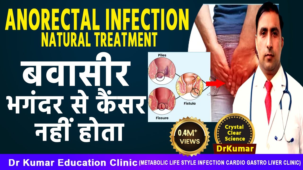 PILES COMPLETE NATURAL TREATMENT FOOD LIFESTYLE TIPS YouTube