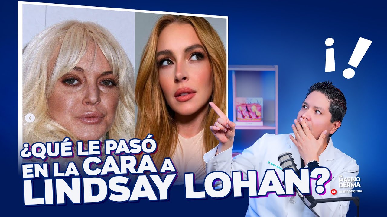 qu-se-hizo-en-la-cara-lindsay-lohan-dermat-logo-opina-youtube
