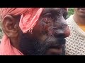black bear attacked two men in anderwan ganderbal |critical injured|😞😞|refered to soura