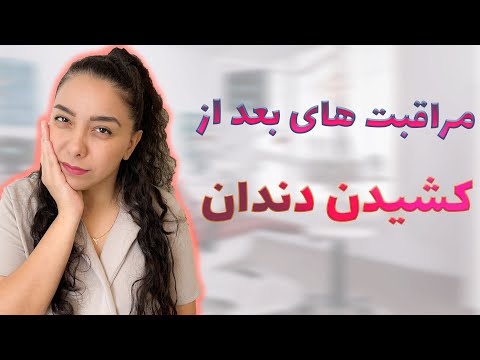 مراقبت های بعد از دندان کشیدن راهنمای جامع