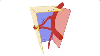 Pterygopalatine Fossa  Anatomy, Contents and Borders