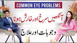 How To Treat Red, Itchy Eyes Naturally & Safely Dr. Hira Qas Health
