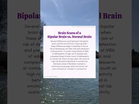 Bipolar Disorder Brain Scans of a Bipolar Brain vs. Normal Brain by Choosing Therapy